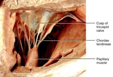 If due to some ingury the chordae tandinae of the tricuspid valve is